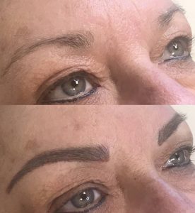 Eyebrows after treatment